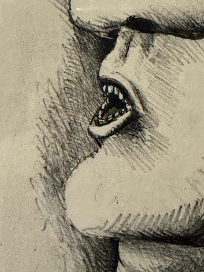 "Kopffüßler mit einer Wunde (Head-Footer with a Wound)" Lithograph by Horst Ante